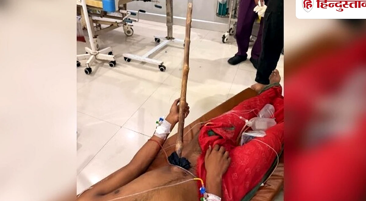 पेट में तीन फीट तक घुसी लाठी, चार घंटे तक चली सर्जरी, 10वीं के छात्र को मौत से बचा लाए डॉक्टर