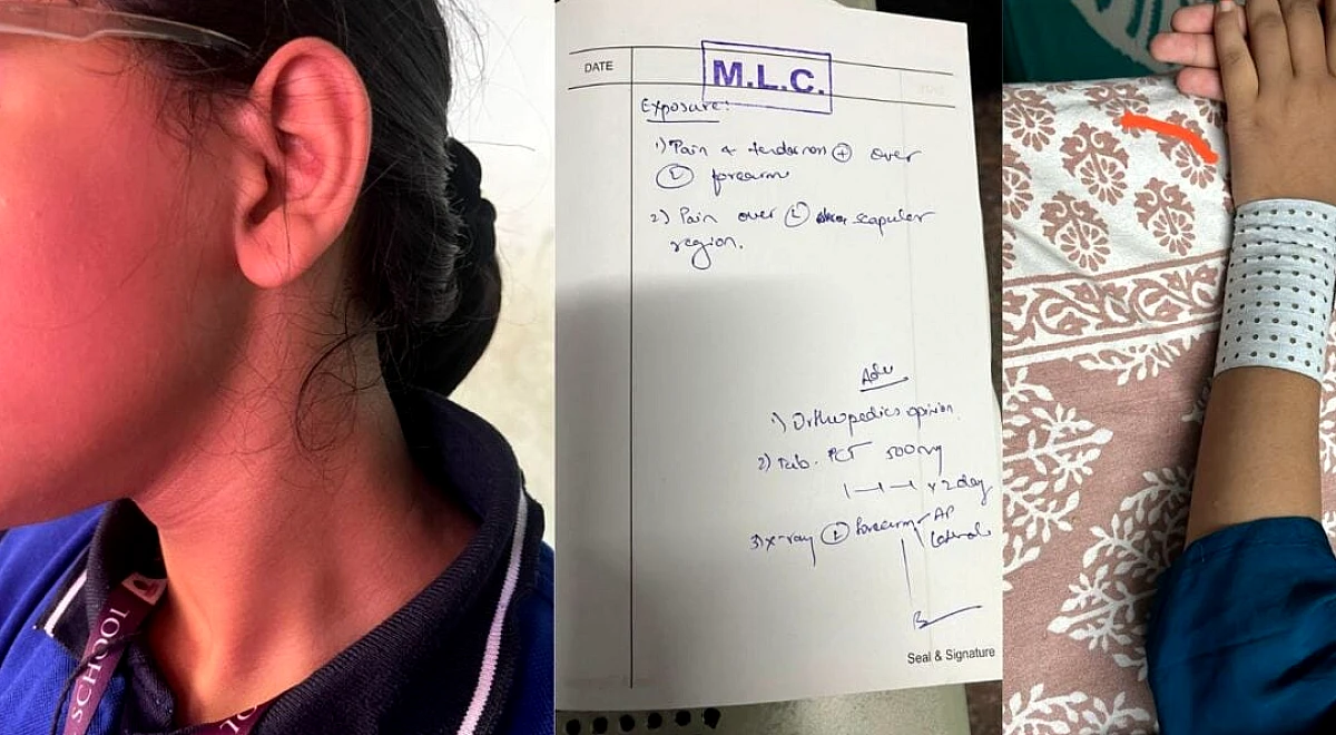 हाथ, पीठ, जांघ पर मारा': बेंगलुरु कक्षा 9 के छात्र को गणित शिक्षक ने पीटा, FIR दर्ज की गई