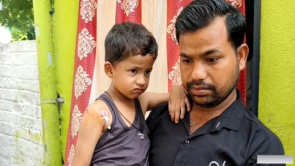 घर के बाहर खेलना पड़ा भारी! आवारा कुत्ते ने 4 साल के बच्चे को बनाया शिकार, सिर-कंधे पर जख्म