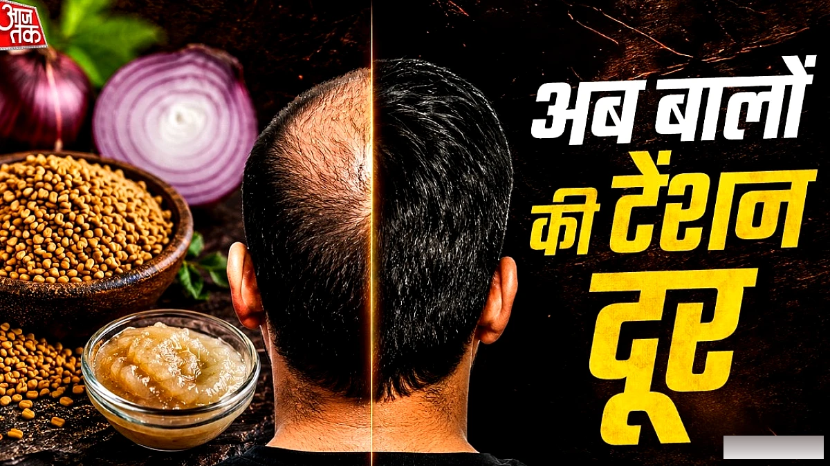 बारिश में तेज हो गया हेयरफॉल? प्याज के रस में मिलाकर लगाएं ये एक चीज