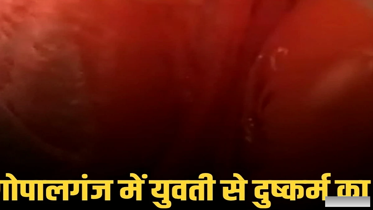 गोपालगंज बरौली में युवती पर दुष्कर्म का प्रयास, विरोध में मारपीट कर घायल किया