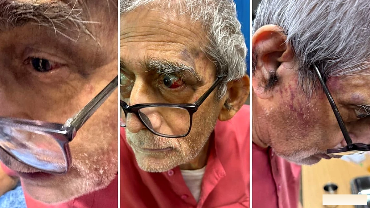 बीएचयू में प्रोफेसर टीके लहरी पर थप्पड़, अस्पताल ने जांच शुरू की