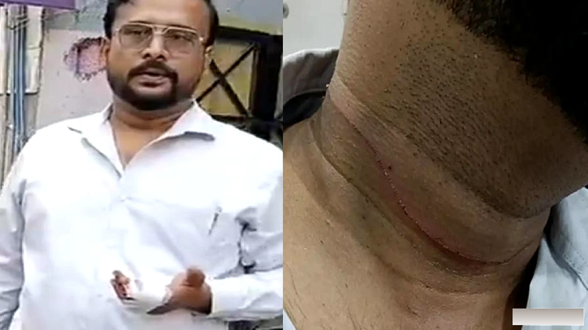कानपुर में बैंक अधिकारी पर चीनी साँप ने हमला किया, उंगली कटी, शिकायत दर्ज