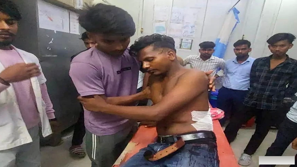 लुटेरों ने चाकू मारा, गोली चलाई, फिर भी ज्वलेरी शॉप बचा ली; भीड़ ने दो अपराधियों को दबोचा