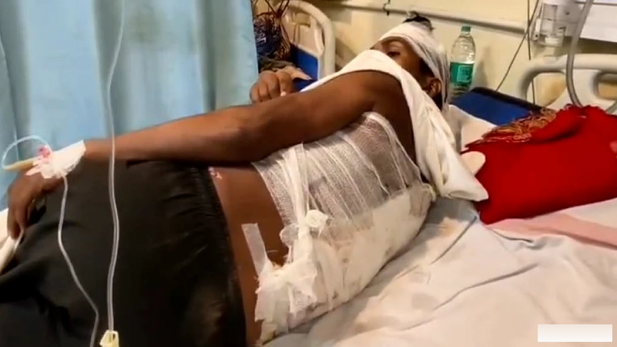 मनीगाछी में पुलिस टीम पर ग्रामीणों का हमला, पथराव में वाहन का शीशा टूटा; ASI घायल