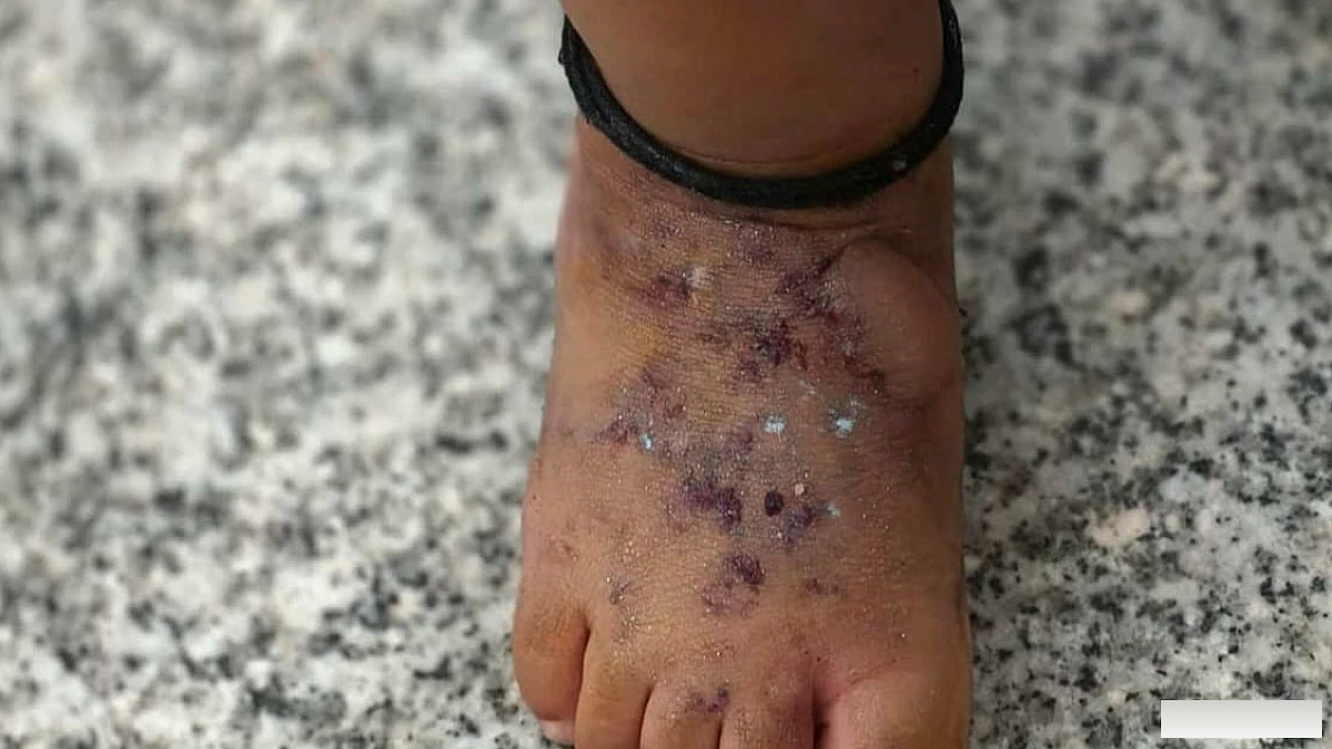 वंदे भारत में फूटा गिलास बना हादसे की वजह, गर्म पानी से एक साल के मासूम का पैर झुलसा