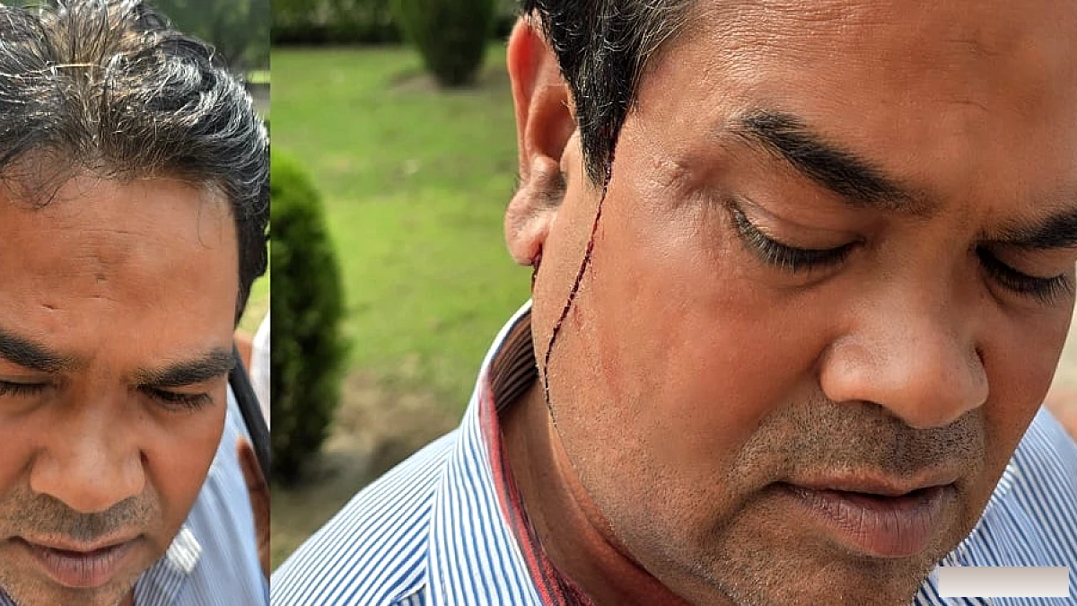 ताज पर फोटोग्राफरों की झड़प: एक गंभीर घायल, पुलिस ने घटना की जाँच शुरू