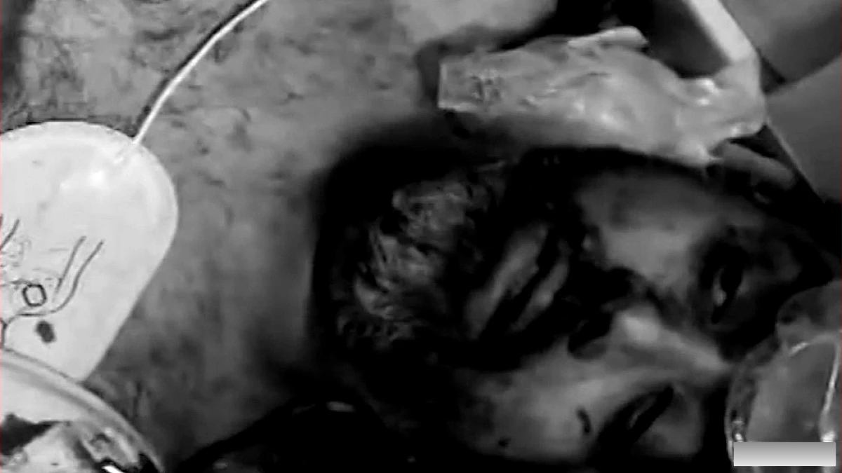को‑पायलट पर हमले के बाद घायल पायलट की वीडियो जारी, देखें