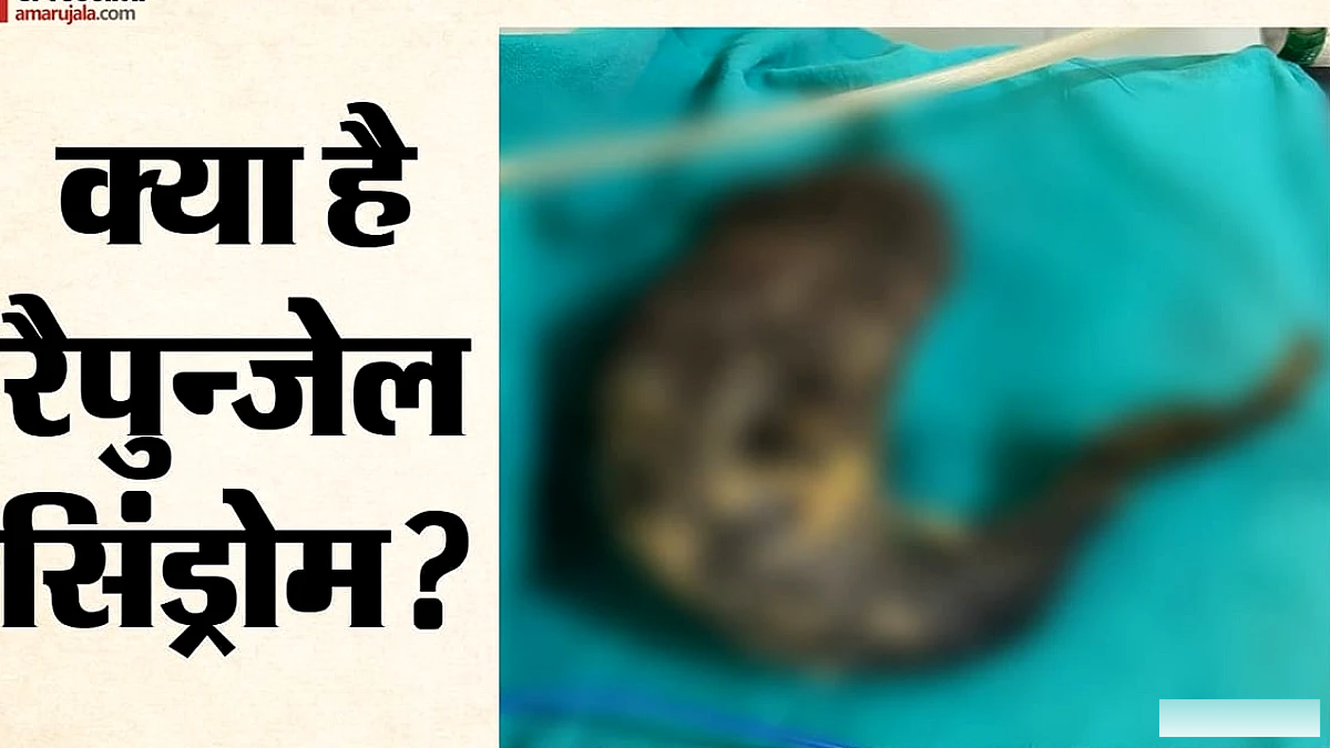 केरल में नौ वर्षीय लड़की के पेट में दर्द: सर्जरी में मिला चौंकाने वाला कारण